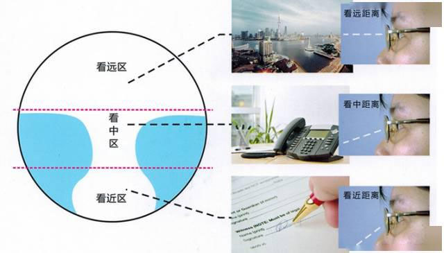 漸進(jìn)多焦鏡 漸進(jìn)多焦鏡